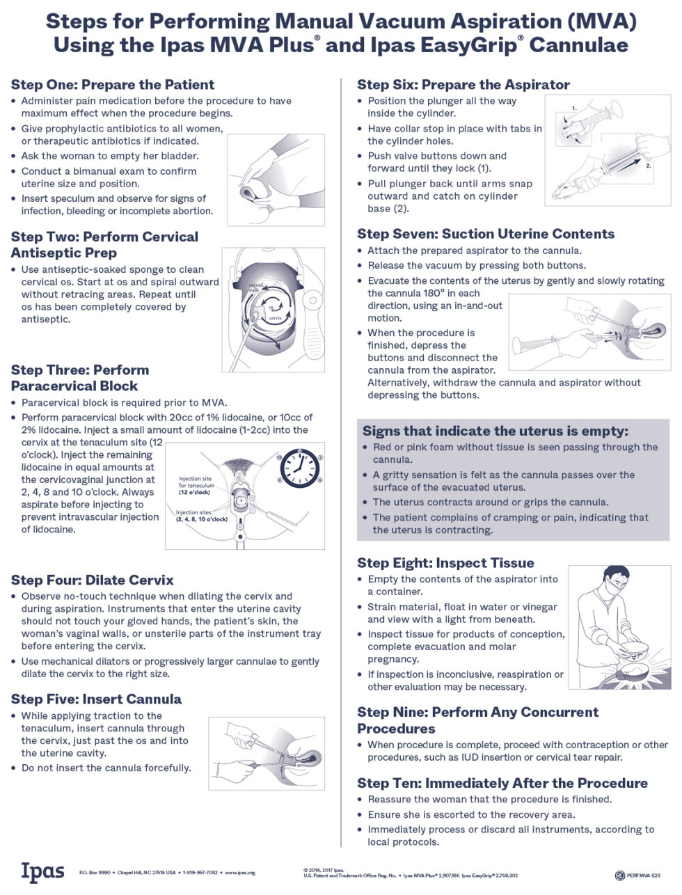 Steps for performing manual vacuum aspiration using the Ipas MVA Plus